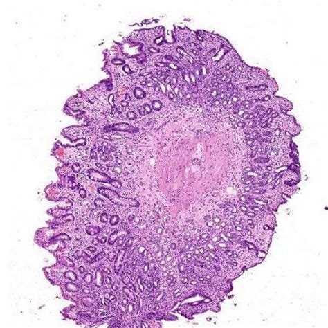 Prepared Microscope Slide E Slides Of Pathology - Histopathology ...