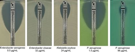 Interpretation of Etest results. C/T Etest strips were placed onto... | Download Scientific Diagram