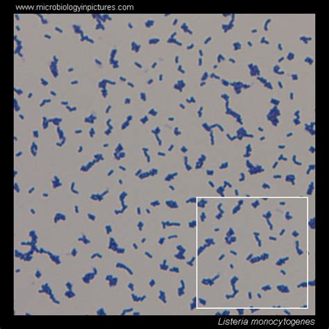 Listeria Monocytogenes Gram Stain Morphology | The Best Porn Website