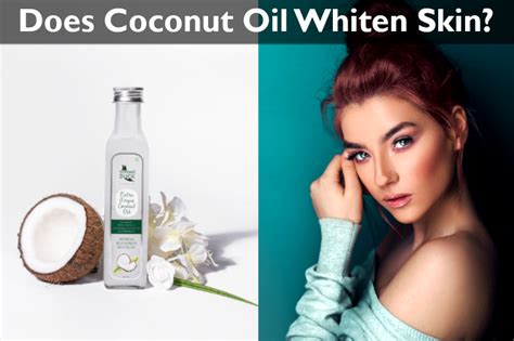 Does Coconut Oil Whiten Skin? : Unlock the Secret!