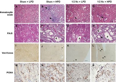 Excessive phosphaturia promotes renal injury. Renal samples from Sham +... | Download Scientific ...