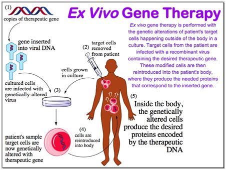 Short Lecture on Gene Therapy - Pharma Mirror Magazine