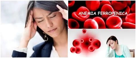 Anemia ferropenica: ¿Qué Es? Síntomas, Causas y Tratamiento – Arriba Salud