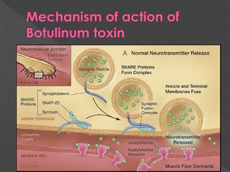 PPT - Cosmetic Uses Of Botox PowerPoint Presentation - ID:1422961