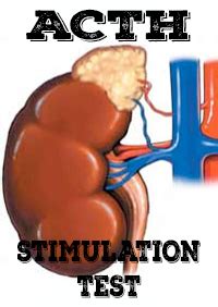 Chris' explanation of the ACTH STIMULATION TEST (aka STIM) - Stop The Thyroid Madness