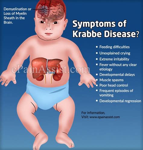 christensen-krabbe disease | Genetic disorders, Disease, Developmental ...