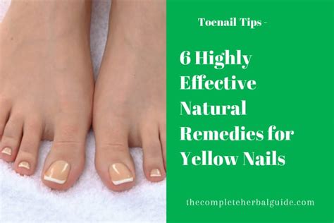 6 Highly Effective Yellow Toenail Cures - The Complete Herbal Guide