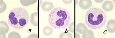 a) Segmented neutrophil, b) controversial band cell, c) band cell | Download Scientific Diagram