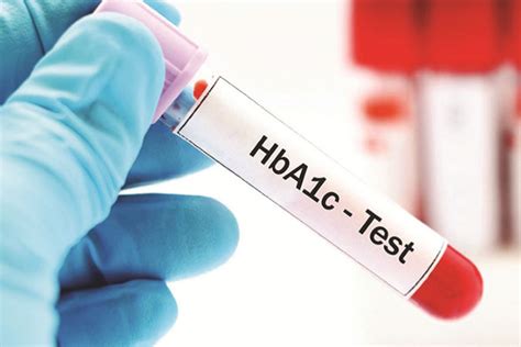 HbA1c chart, HbA1c test, normal HbA1c level and HbA1c range diabetes