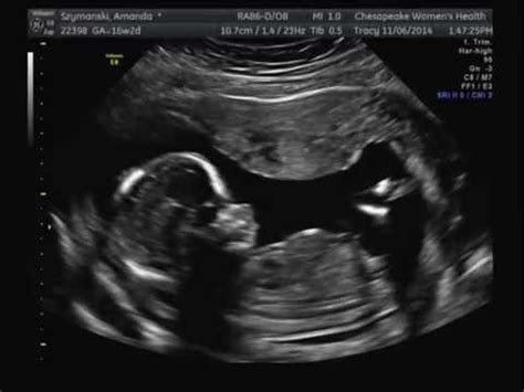 16 Weeks Pregnant Ultrasound