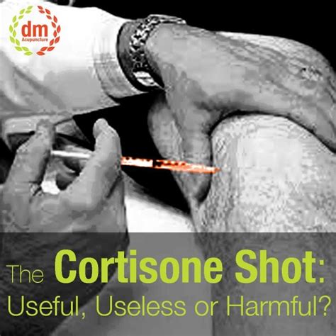 Cortisone Shot: Useful, or Harmful? | DM Acupuncture