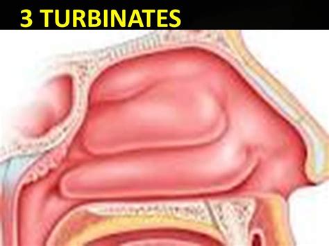 ENLARGMENT OF INFERIOR TURBINATES DR. FOHEID ALSOBEI - YouTube