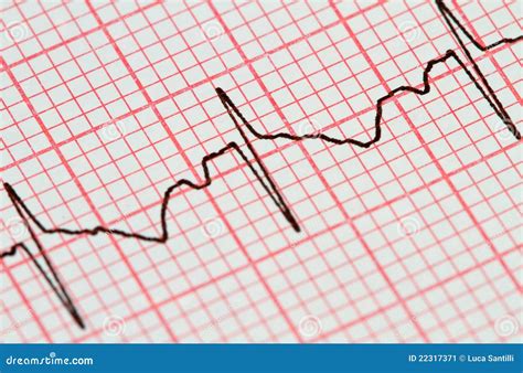 Electrocardiogram stock image. Image of cardiologist - 22317371