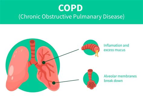 human Lungs vector clip art icon. COPD vector illustration, chronic ...