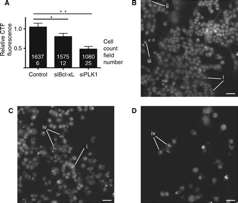 A High-Throughput, Multiplex Cell Death Assay Using an RNAi Screening Approach