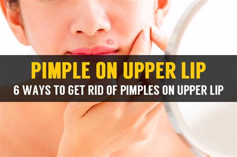 Learn How To Treat Pimple On Upper Lip & Causes