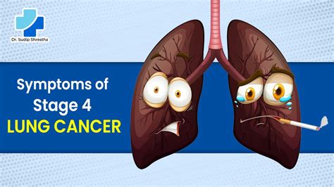 Symptoms of stage 4 lung cancer - Dr Sudip Shrestha