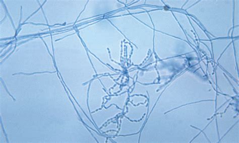 Actinomyces spp & Nocardia spp | Clinician's Brief