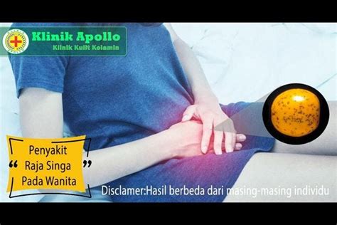 Pengobatan Penyakit Raja Singa Pada Wanita | by Klinik Apollo Official | Medium