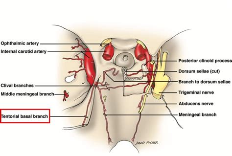 The Tentorium Cerebelli: A Comprehensive Review Including Its Anatomy ...