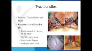 Anatomy and Epidemiology of ACL Injury - UOANJ - NJ Orthopaedic Associates