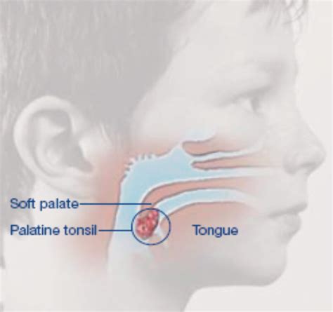 Palatine tonsil - Anatomy, Functions, Location and Pictures