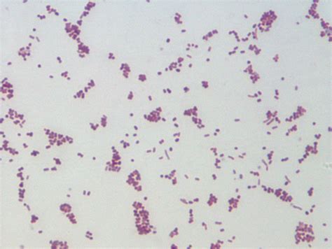 Pseudomonas Aeruginosa Gram Stain 1000x | www.pixshark.com - Images ...