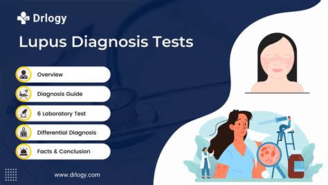 What is the role of antibody tests in lupus diagnosis?