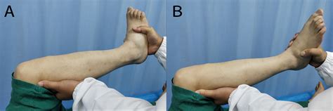 | MRI images of the knees of normal people and of patients with... | Download Scientific Diagram