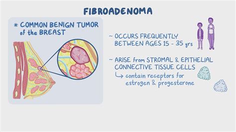 Types Fibroadenoma With Cell Changes