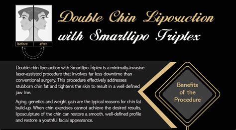 Double Chin Liposuction with Smartlipo Triplex