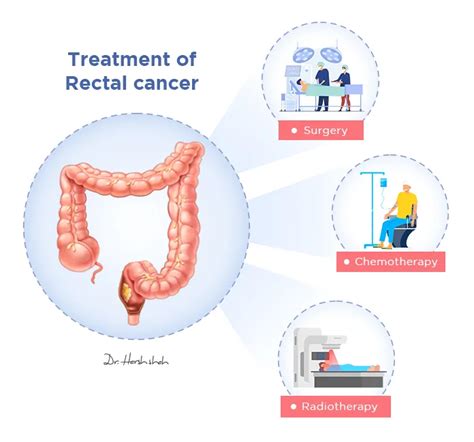 Best Rectal Cancer Hospital in Ahmedabad, India