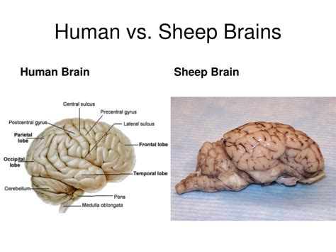 Sylvian Fissure Sheep Brain Ch Gross Anatomy Of The Brain And | My XXX ...