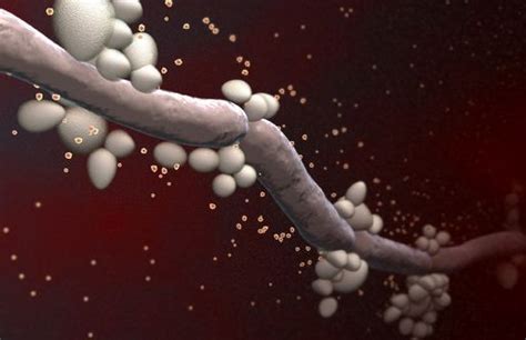 Mucocutaneous Candidiasis Basics Description A mucocutaneous disorder ...