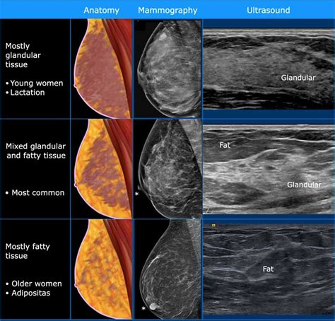 Top 10 ultrasound ideas and inspiration