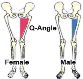 The Q-Angle – And its training implications for females - Functional ...