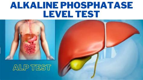 Alkaline Phosphatase Level Test (ALP) - What causes alkaline phosphatase levels to be high ...