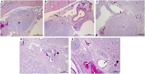 Microscopy photographs taken at the edge of the trigeminal ganglion... | Download Scientific Diagram