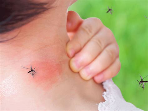 How to know if you’ve been bitten by a dengue mosquito: 5 facts about ...