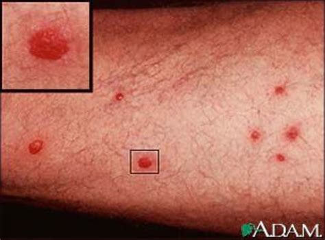 13 Causes of Red Spots on Skin