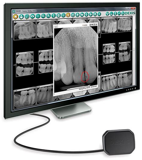 Digital X-Rays - Portland Perio Implant Center