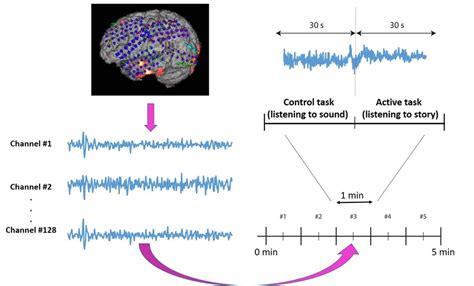 Subdural grid localization and position of ECoG electrodes on the brain... | Download Scientific ...