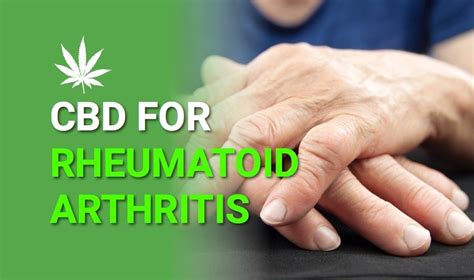 CBD Oil Arthritis Dosage – PainControl.net