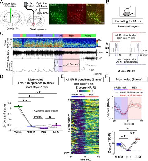 Deficiency of orexin signaling during sleep is involved in abnormal REM ...