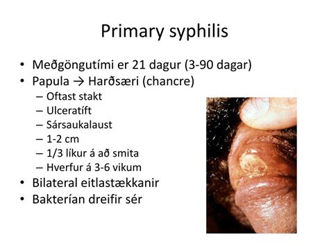 Stages Of Syphilis Chart