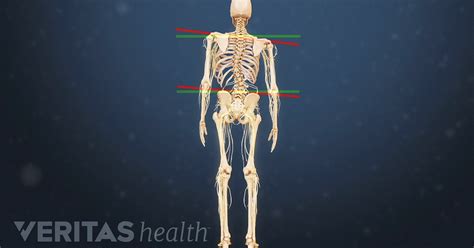 Degenerative Scoliosis Video