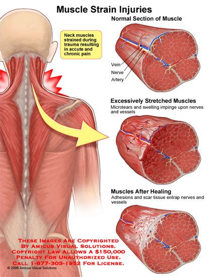 Muscular System - ariannalipton