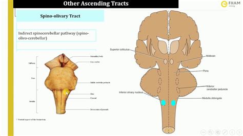 Spinoreticular Tract Pathway