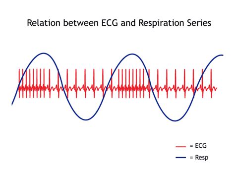 All About HRV Part 4: Respiratory Sinus Arrhythmia – MindWare Technologies Support