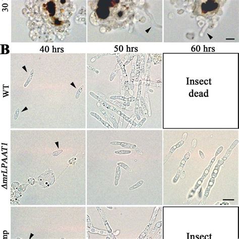 Fungal propagation in insect hemocoel. A. Conidia of the WT and mutants... | Download Scientific ...